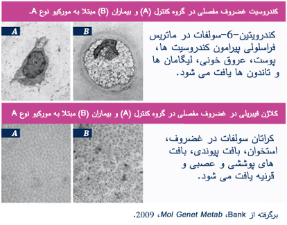 genetics_and_pathophysiology